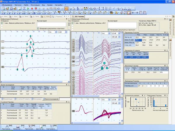 Stimulator magnetic pentru diagnostic NEURO-MS/D