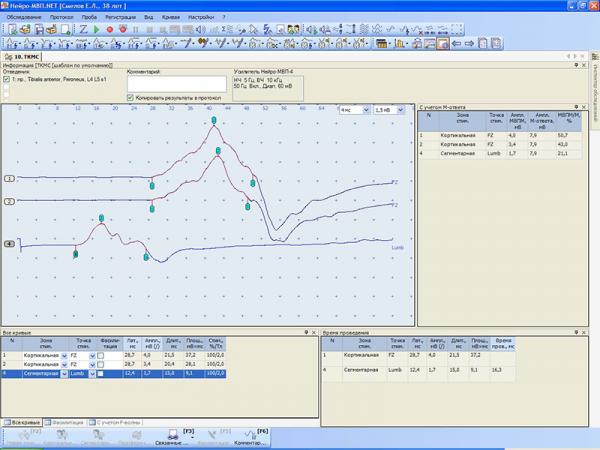 Stimulator magnetic pentru diagnostic NEURO-MS/D