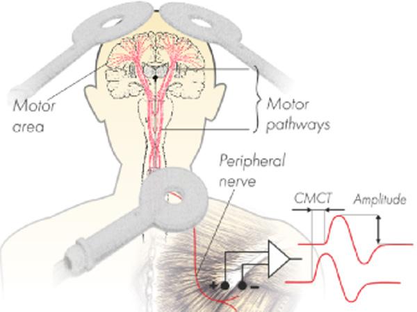 Stimulator magnetic pentru diagnostic NEURO-MS/D