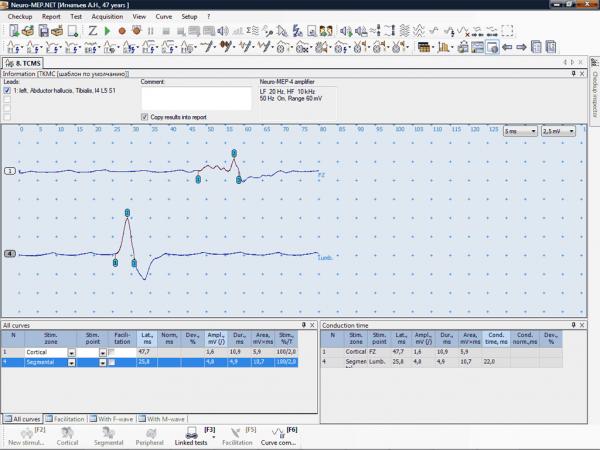 Electroneuromiograf  2 canale NEURO-MEP-MICRO