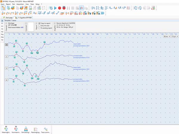 Electroneuromiograf  4 canale NEURO-MEP-4