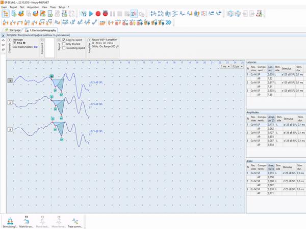 Electroneuromiograf  4 canale NEURO-MEP-4