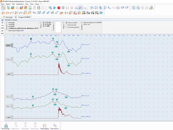 Electroneuromiograf  4 canale NEURO-MEP-4