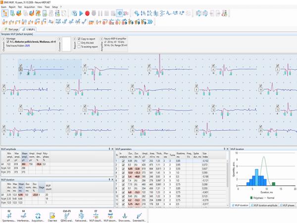 Electroneuromiograf  4 canale NEURO-MEP-4