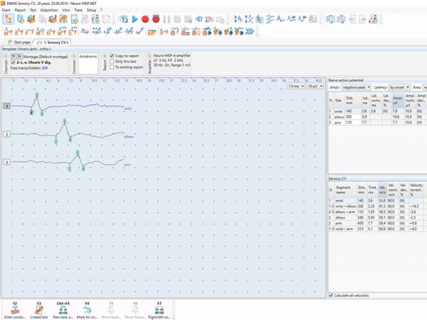 Electroneuromiograf  4 canale NEURO-MEP-4