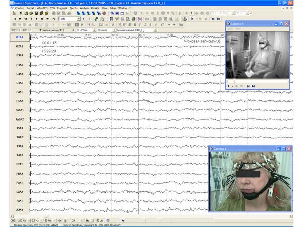 Neuron-Spectrum-Video pentru Neuron Spectrum 5-1