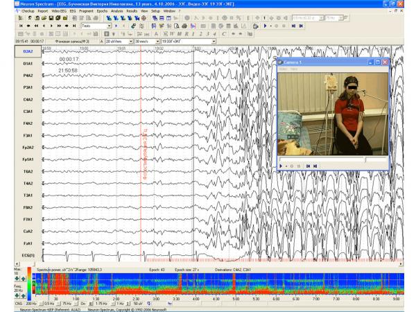 Neuron-Spectrum-Video pentru Neuron Spectrum 5-1