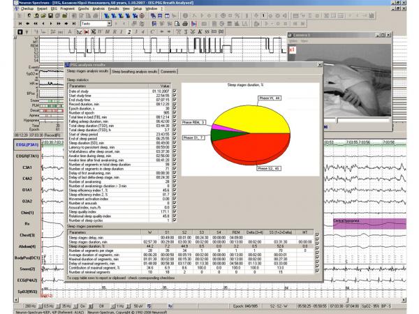 Neuron-Spectrum-Video pentru Neuron Spectrum 5-1