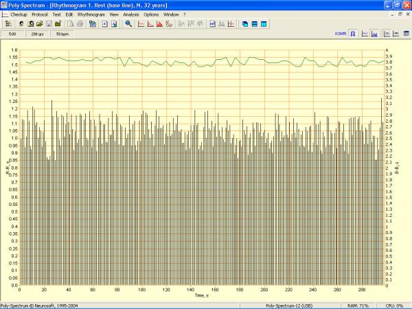 Soft analiza variabiltatii ritmului cardiac POLY-SPECTRUM-RHYTHM/ECG