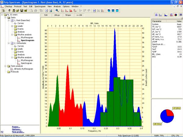 Soft analiza variabiltatii ritmului cardiac POLY-SPECTRUM-RHYTHM/ECG