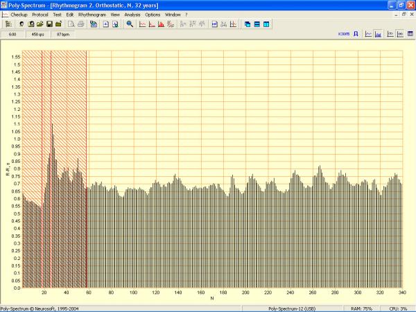 Soft analiza variabiltatii ritmului cardiac POLY-SPECTRUM-RHYTHM/ECG