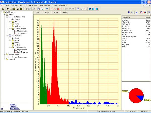 Soft analiza variabiltatii ritmului cardiac POLY-SPECTRUM-RHYTHM/ECG