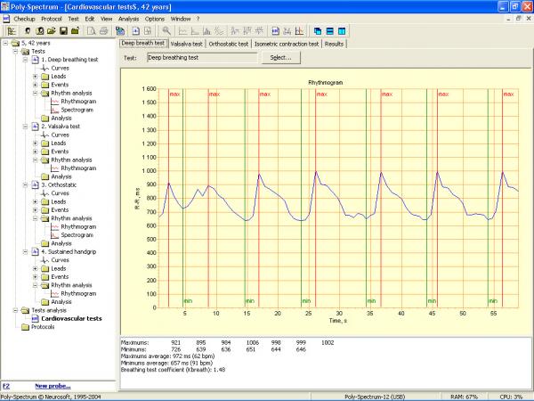 Soft analiza variabiltatii ritmului cardiac POLY-SPECTRUM-RHYTHM/ECG