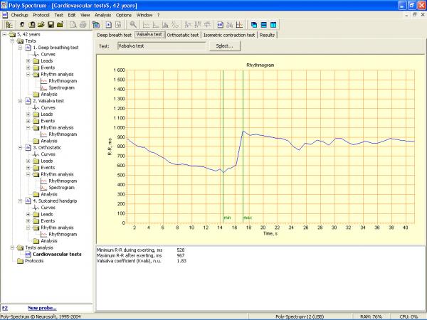 Soft analiza variabiltatii ritmului cardiac POLY-SPECTRUM-RHYTHM/ECG