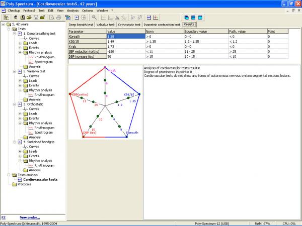 Soft analiza variabiltatii ritmului cardiac POLY-SPECTRUM-RHYTHM/ECG