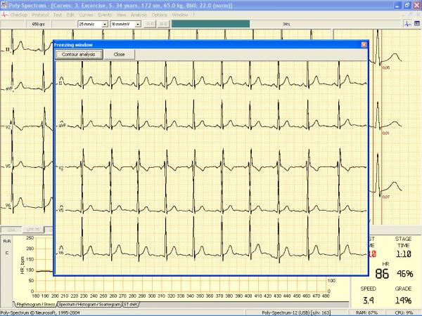 Soft analiza ECG teste de efort POLY-SPECTRUM-ERGO