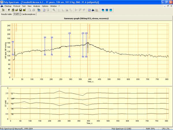 Soft analiza ECG teste de efort POLY-SPECTRUM-ERGO