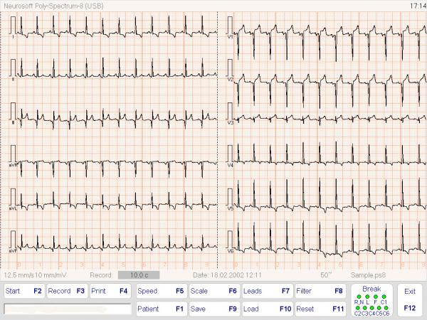 Electrocardiograf POLY-SPECTRUM-8EX