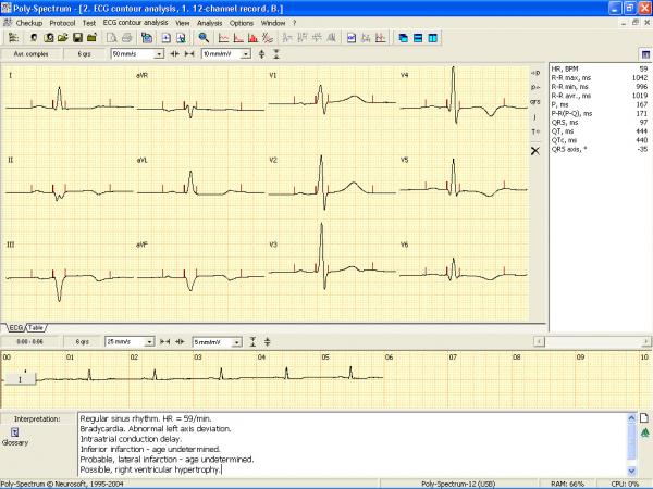 Electrocardiograf POLY-SPECTRUM-8EX