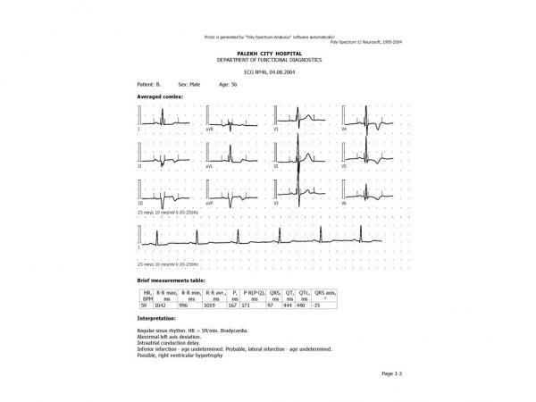 Electrocardiograf POLY-SPECTRUM-8EX