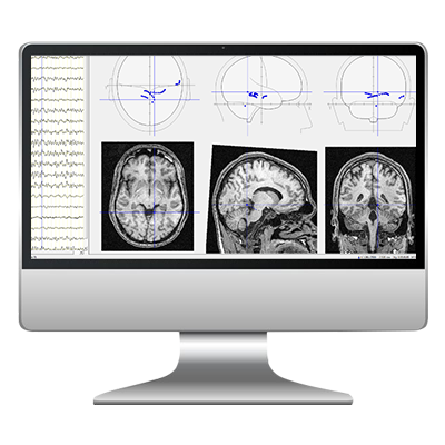 Soft Localizare a focarelor cu activitate patologica BrainLoc 6.0