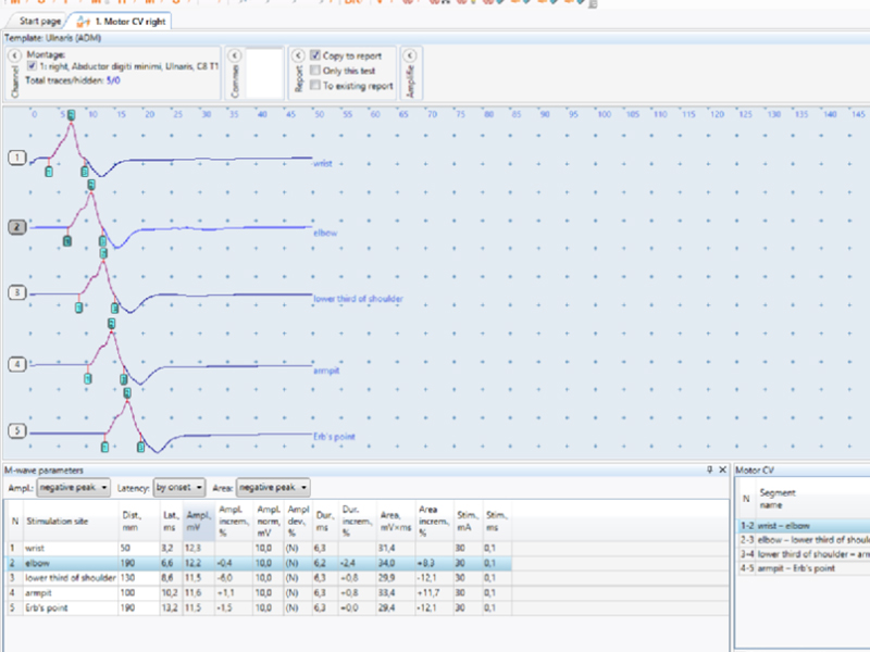 Soft si accesorii Electroneuromiografie Neuron-Spectrum-EMG