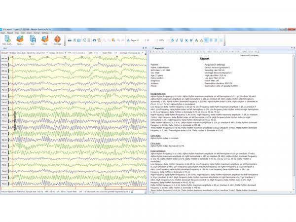 Electroencefalograf - 41 canale NEURON-SPECTRUM-5