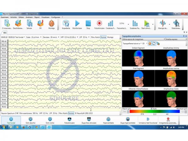 Electroencefalograf - 19 canale NEURON-SPECTRUM-3