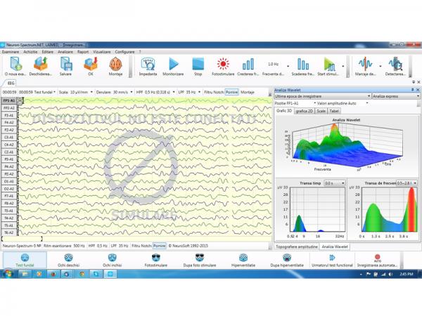 Electroencefalograf - 19 canale NEURON-SPECTRUM-3