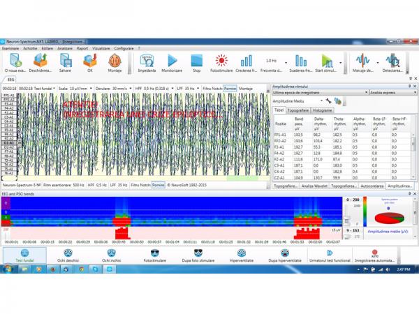 Electroencefalograf - 19 canale NEURON-SPECTRUM-3