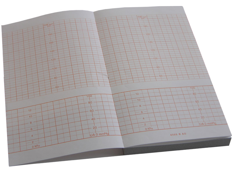 Hartie termica cardiotocograf Top 152 mm x 90 mm x 150 file