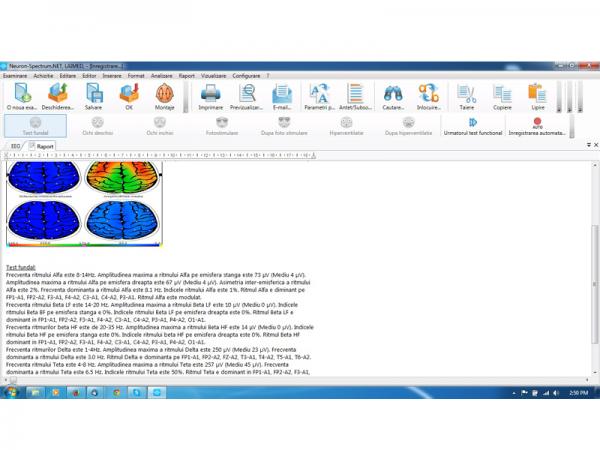 Electroencefalograf - 28 canale NEURON-SPECTRUM-4/P