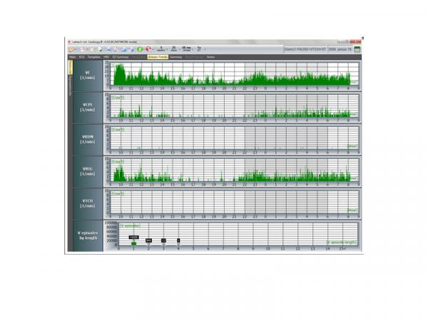 Holter ECG EC 2H