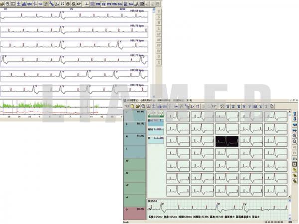 Holter ECG TLC5000 