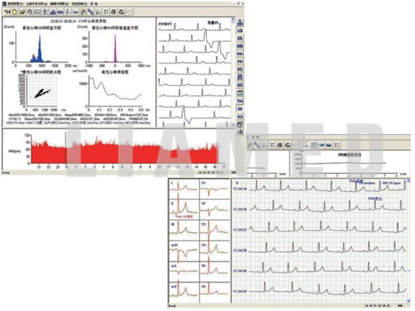 Holter ECG TLC5000 