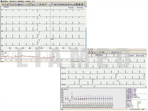 Holter ECG TLC5000 