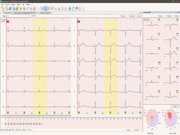 Electrocardiograf computerizat POLY-SPECTRUM-8