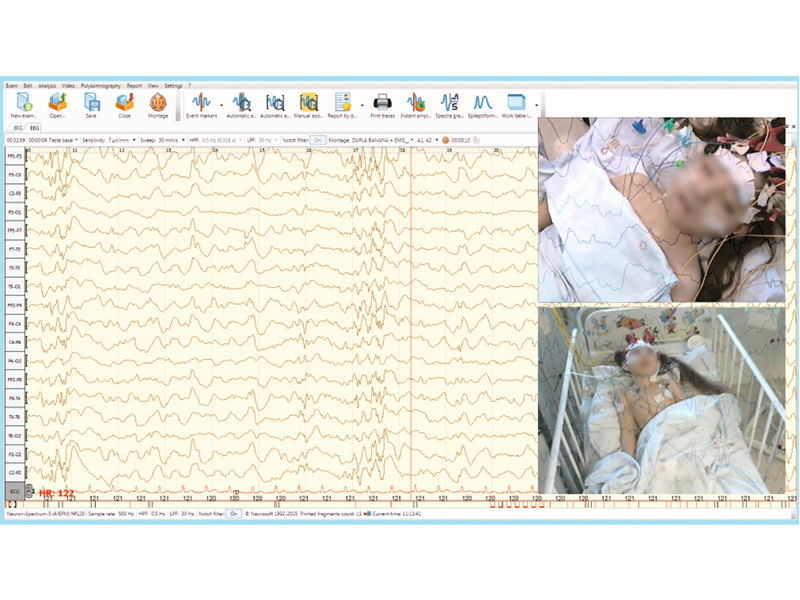 Neuron-Spectrum-Video pentru Neuron Spectrum 65-61