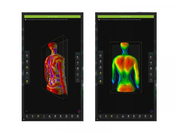 Dispozitiv pentru analiza coloanei vertebrale SPINE 3D cu platforma 