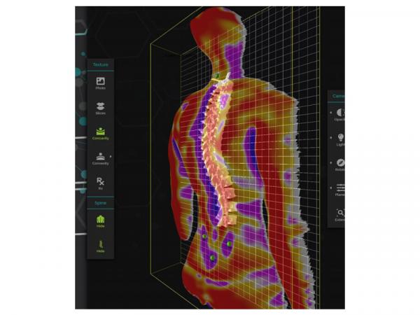 Dispozitiv pentru analiza coloanei vertebrale SPINE 3D cu platforma 