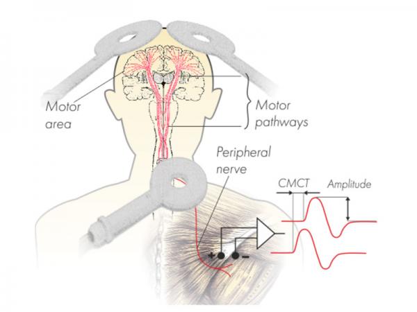 Stimulator magnetic terapeutic avansat NEURO-MS/D 