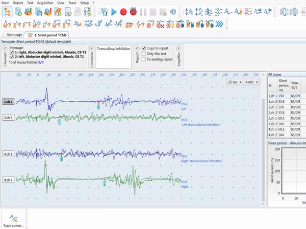 Stimulator magnetic terapeutic avansat NEURO-MS/D 