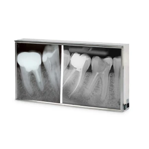 Negatoscop dublu, standard, 80x43cm 