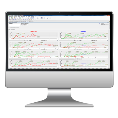 Software ASSR NEURO-AUDIO