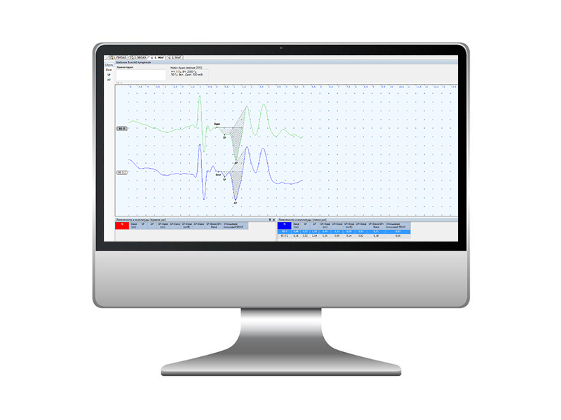 Software de electrocohleografie - ECohG NEURO-AUDIO