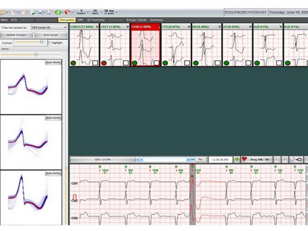 Holter ECG EC 12H