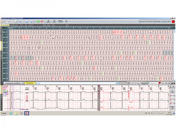 Holter ECG EC 12H