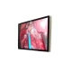 Sistem complet de endoscopie rigida SonoScape 4K 