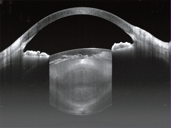 Tomograf in coerenta optica YALKAID YG-100K OPTO HELLAS 