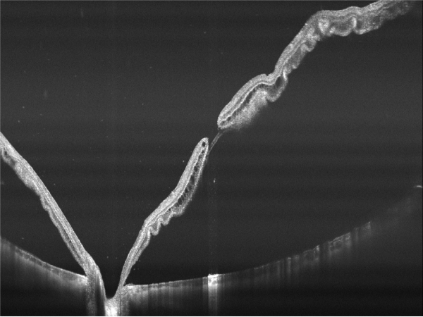 Tomograf in coerenta optica YALKAID YG-100K OPTO HELLAS 